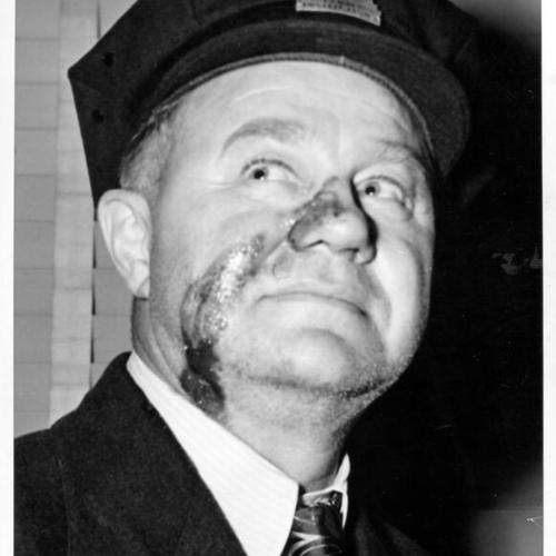 [Ed Miller, associate warden at Alcatraz Prison, whose face was badly burned when a gas grenade was shot from his hand by a rioting convict]